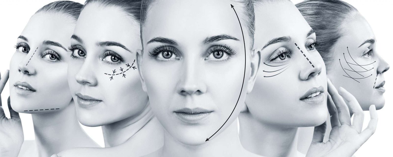 Asimmetria mandibolare nel paziente con deformità dentoscheletrica